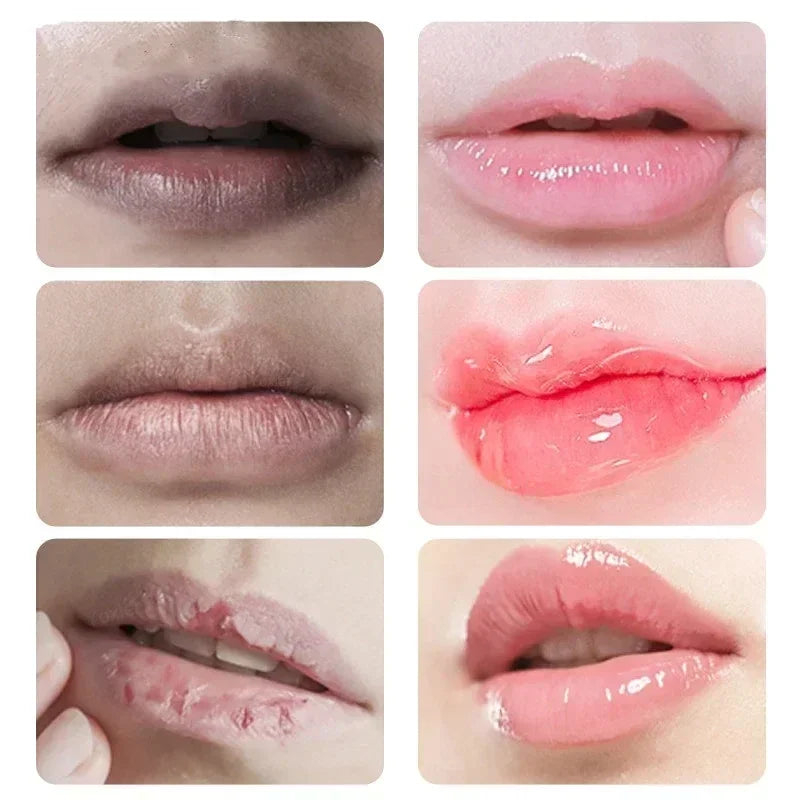 Fast Lightening Pink Mouth Lips Serum Bleaching Permanent Pinkish Moisturizing Lighten Dark Lip Balm Gloss Lipstick Lip Mask