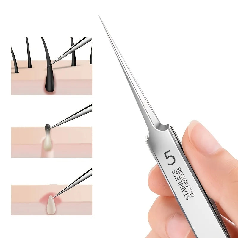 Blackhead Tweezers - Precision acne removal tool for facial whiteheads, acne, pimples - Stainless steel professional makeup tool