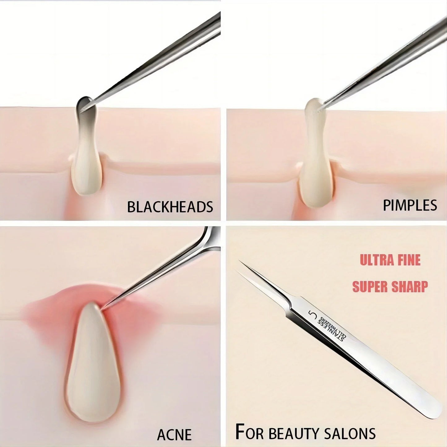 Blackhead Tweezers - Precision acne removal tool for facial whiteheads, acne, pimples - Stainless steel professional makeup tool